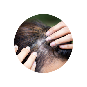 Hair With Roots, Hair Follicles, Alternative Samples, Forensics Canada Inc.